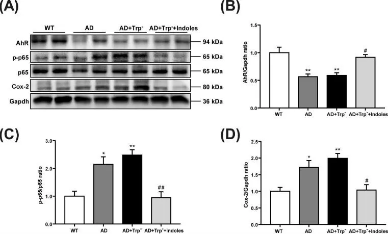 Indole Metabolites Modulate Neuroinflammation in Alzheimer’s Disease IPA and IAA suppress microglial activation and cytokine release through AhR